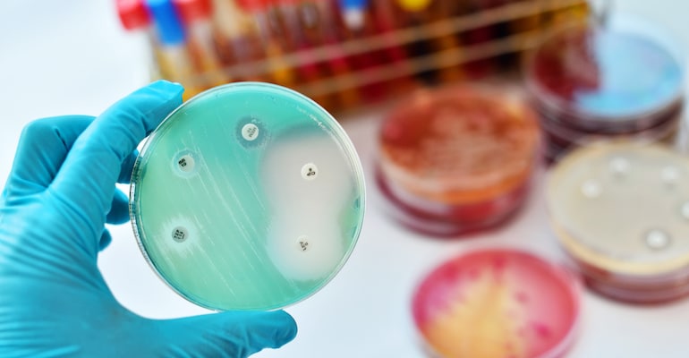 o placuta de laborator care arata rezistenta la antibiotice